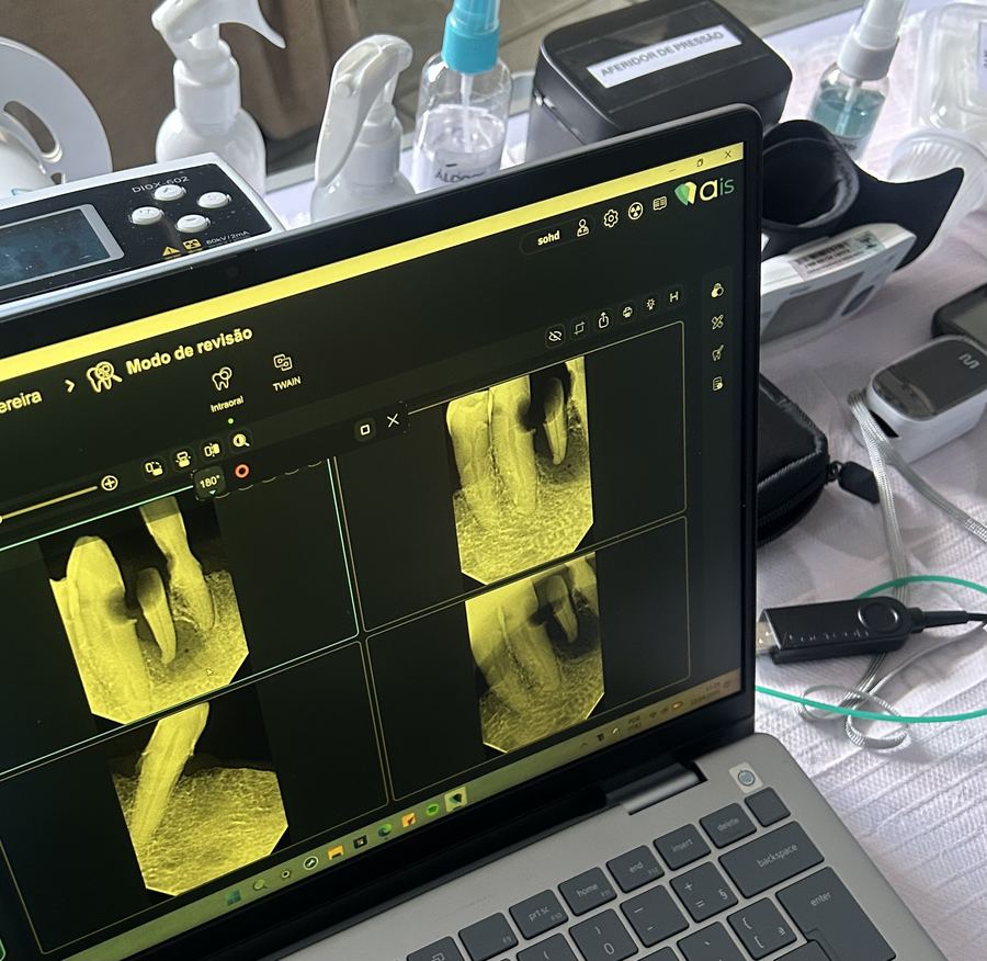 Radiografia odontológica digital feita no domicílio do paciente pela SOHD