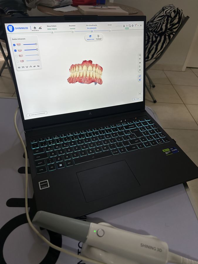 Escaneamento intraoral 3D durante atendimento odontológico domiciliar da SOHD